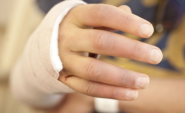 Trật khớp cổ tay bao lâu thì khỏi ?